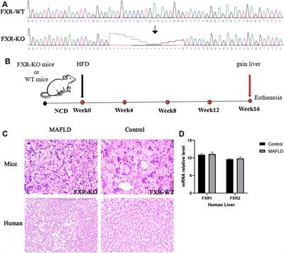 Combined Analysis of Expression Profiles in a Mouse Model and Patients Identified BHMT2 as a New Regulator of Lipid Metabolism in Metabolic-Associated Fatty Liver Disease